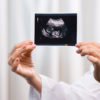 12 самых важных вопросов о беременности Интервью с акушером-гинекологом