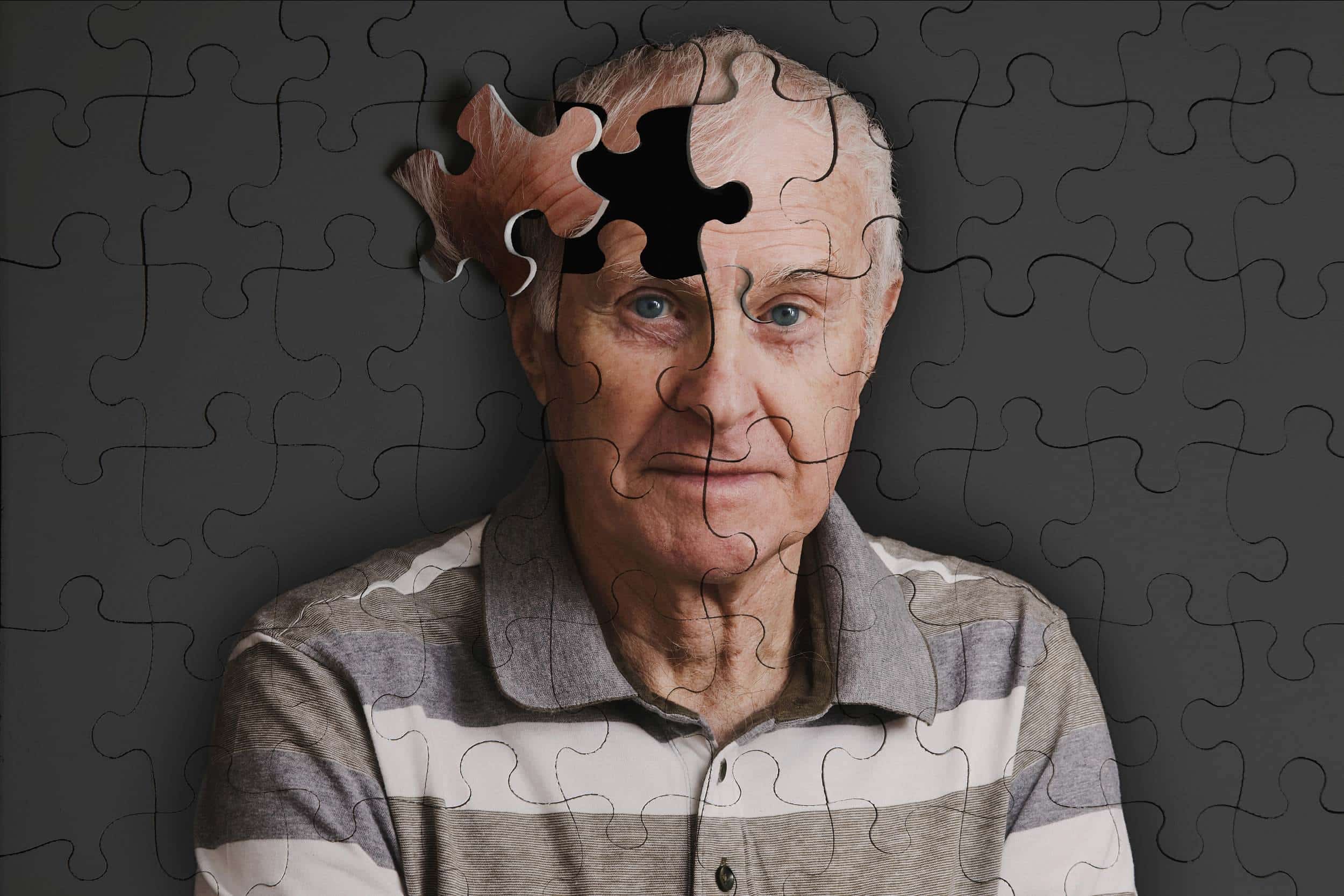 Психические нарушения памяти. Болезнь Альцгеймера деменция. Энн Вудс болезнь Альцгеймера. Старческое слабоумие.